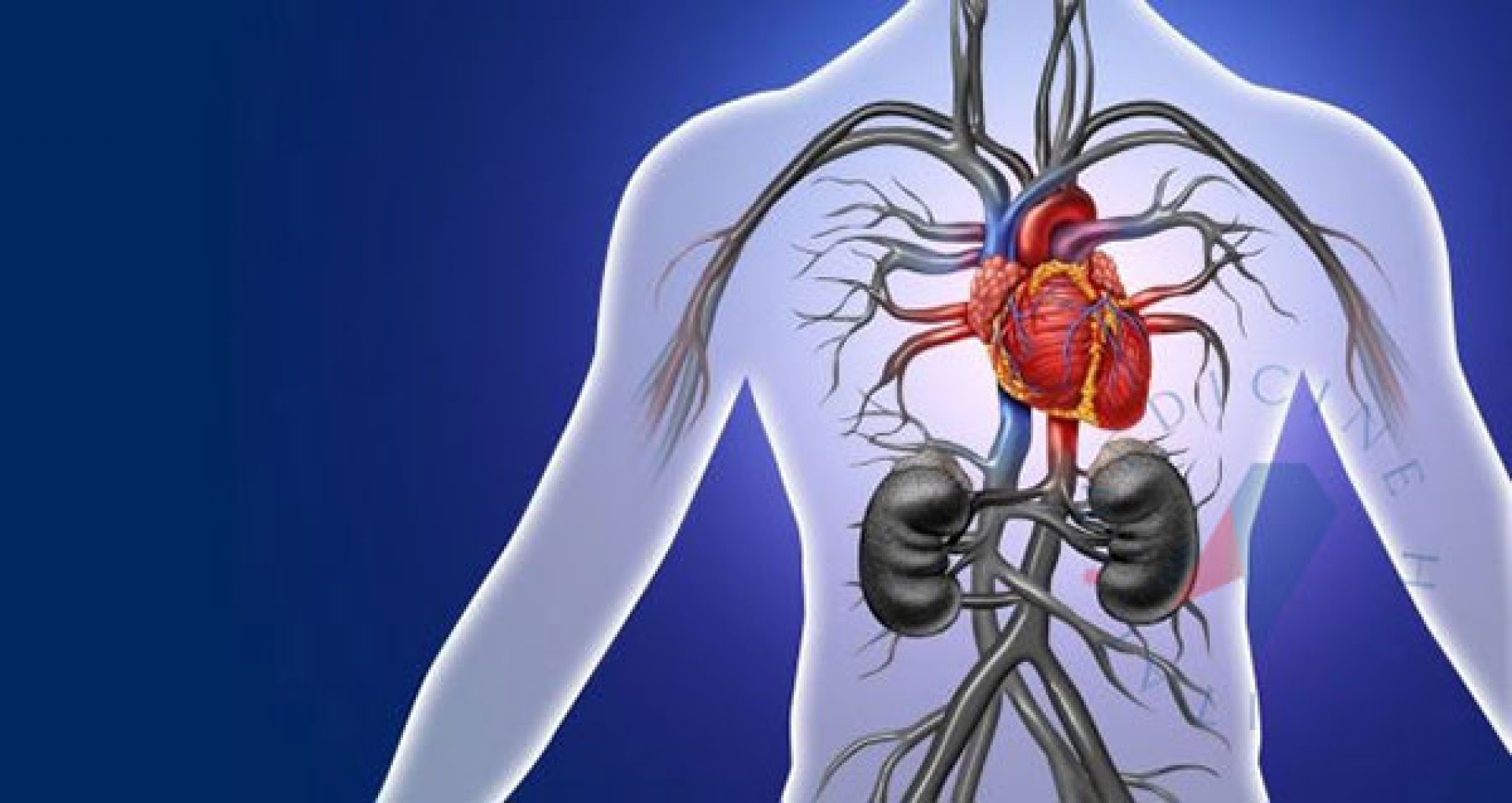 Aortic Dissection