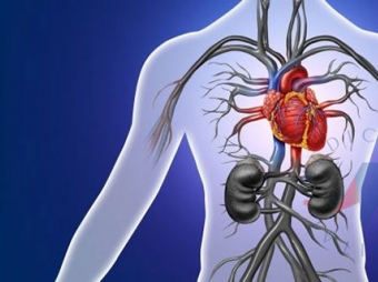 Aortic Dissection