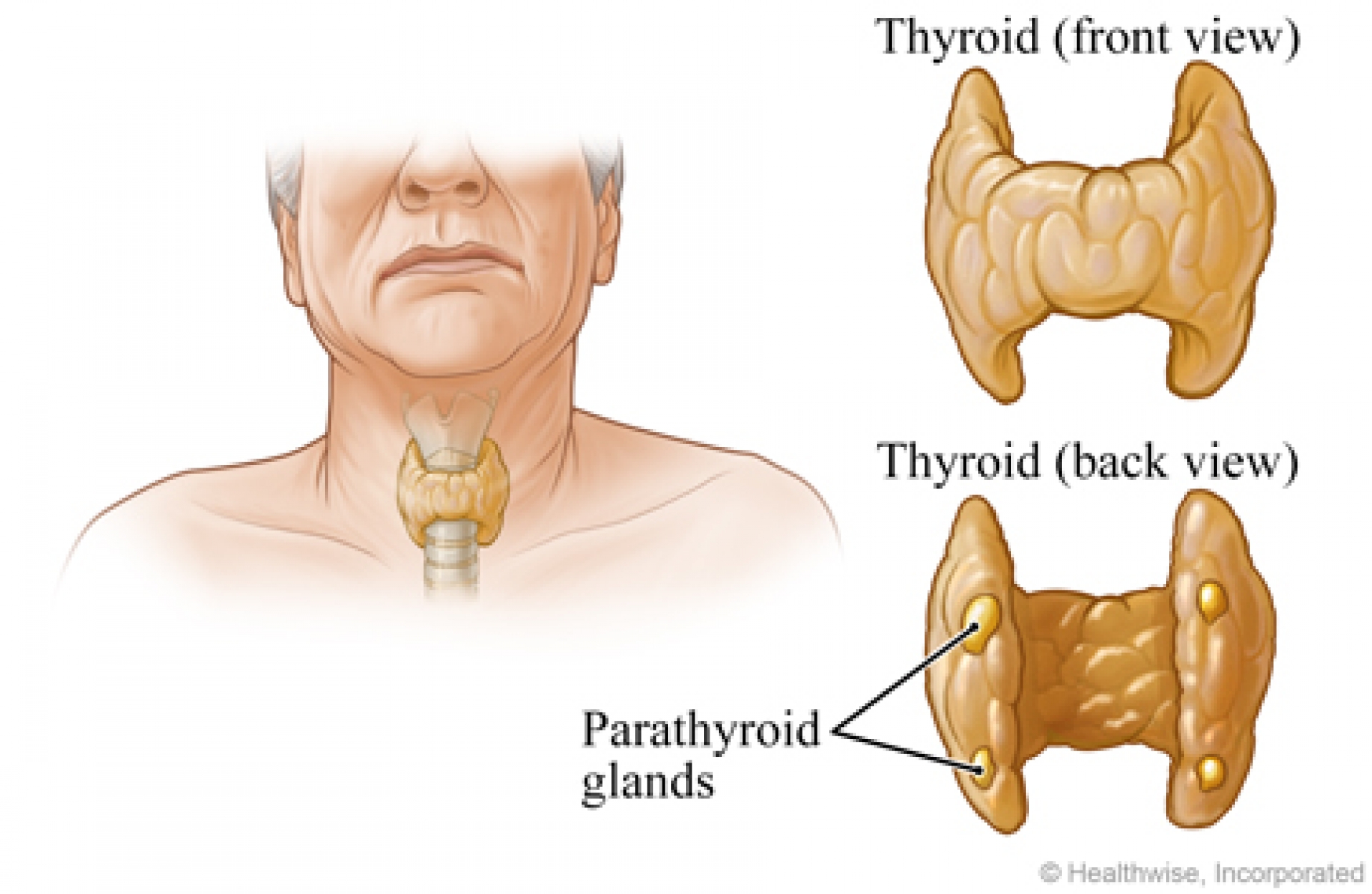 Paratiroid